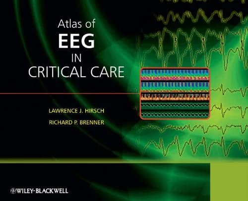 و دانلود نسخه کامل کتاب Atlas of EEG in Critical Care 1st Edition
