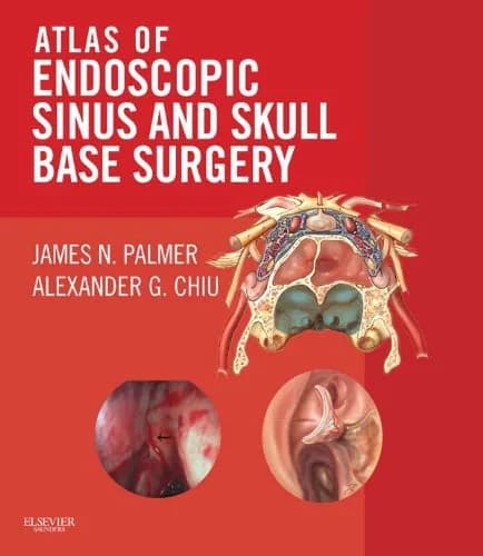و دانلود نسخه کامل کتاب Atlas of Endoscopic Sinus and Skull Base Surgery: Expert Consult – Online and Print 1st Edition