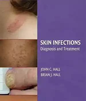 دانلود کتاب Skin Infections: Diagnosis and Treatment