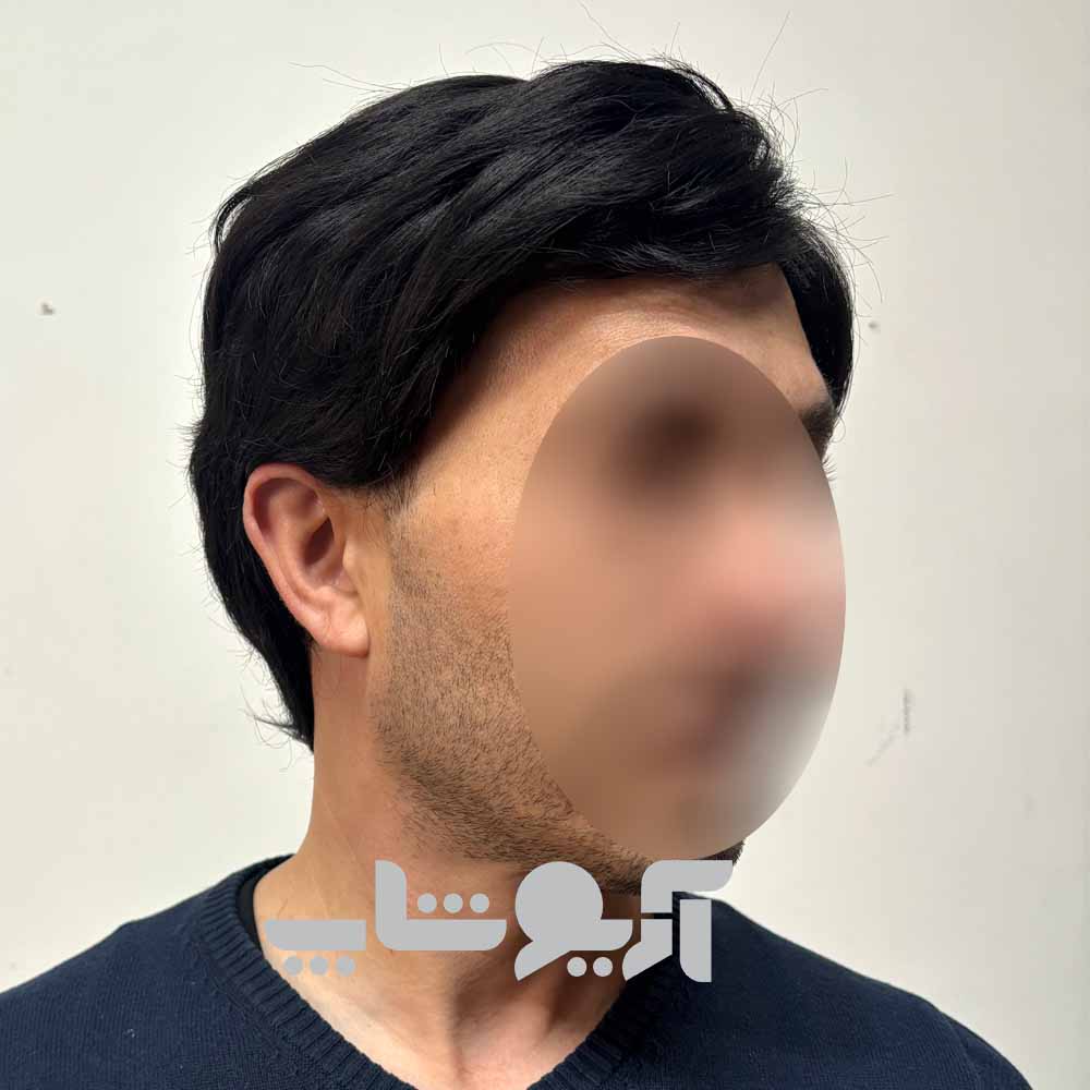 کلاه گیس مردانه کوتاه با الیاف درجه یک خارجی ظاهر طبیعی — تصویر ۵