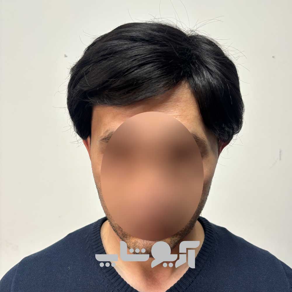 کلاه گیس مردانه کوتاه با الیاف درجه یک خارجی ظاهر طبیعی — تصویر ۶