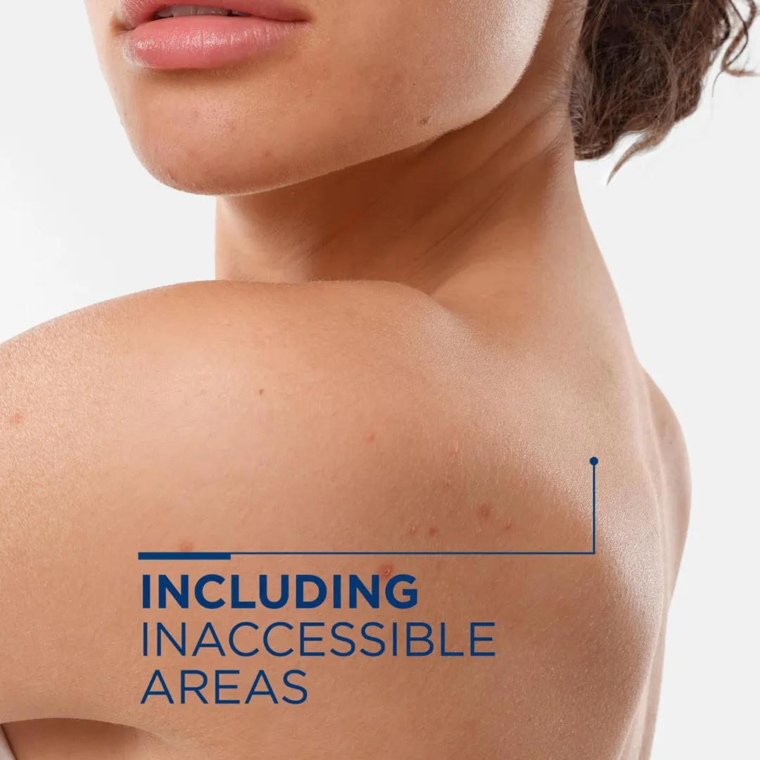 اسپری بدن ضد لک بایودرما SEBIUM KERATO+ BODY حجم 150 میلی لیتری — تصویر ۵
