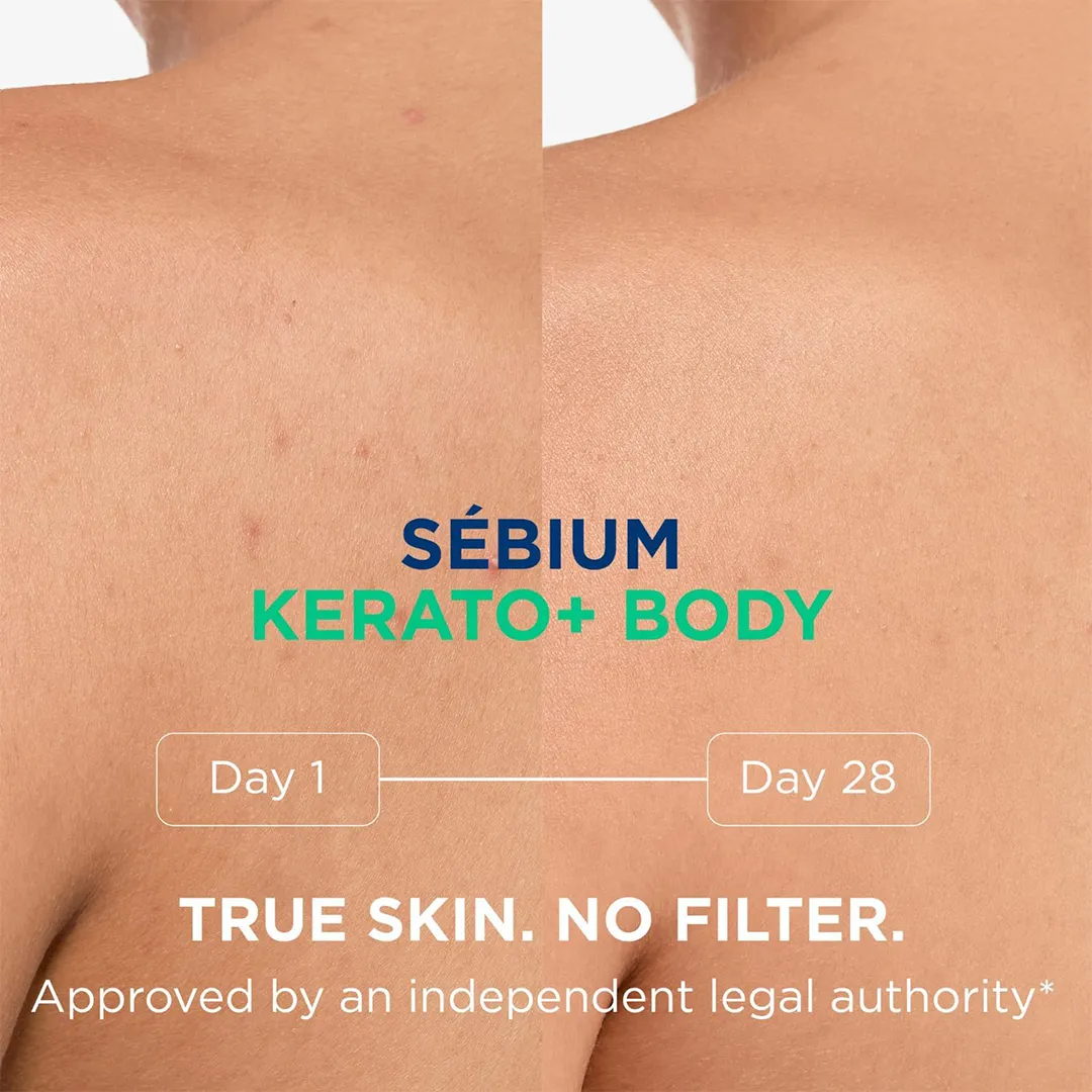 اسپری بدن ضد لک بایودرما SEBIUM KERATO+ BODY حجم 150 میلی لیتری — تصویر ۸