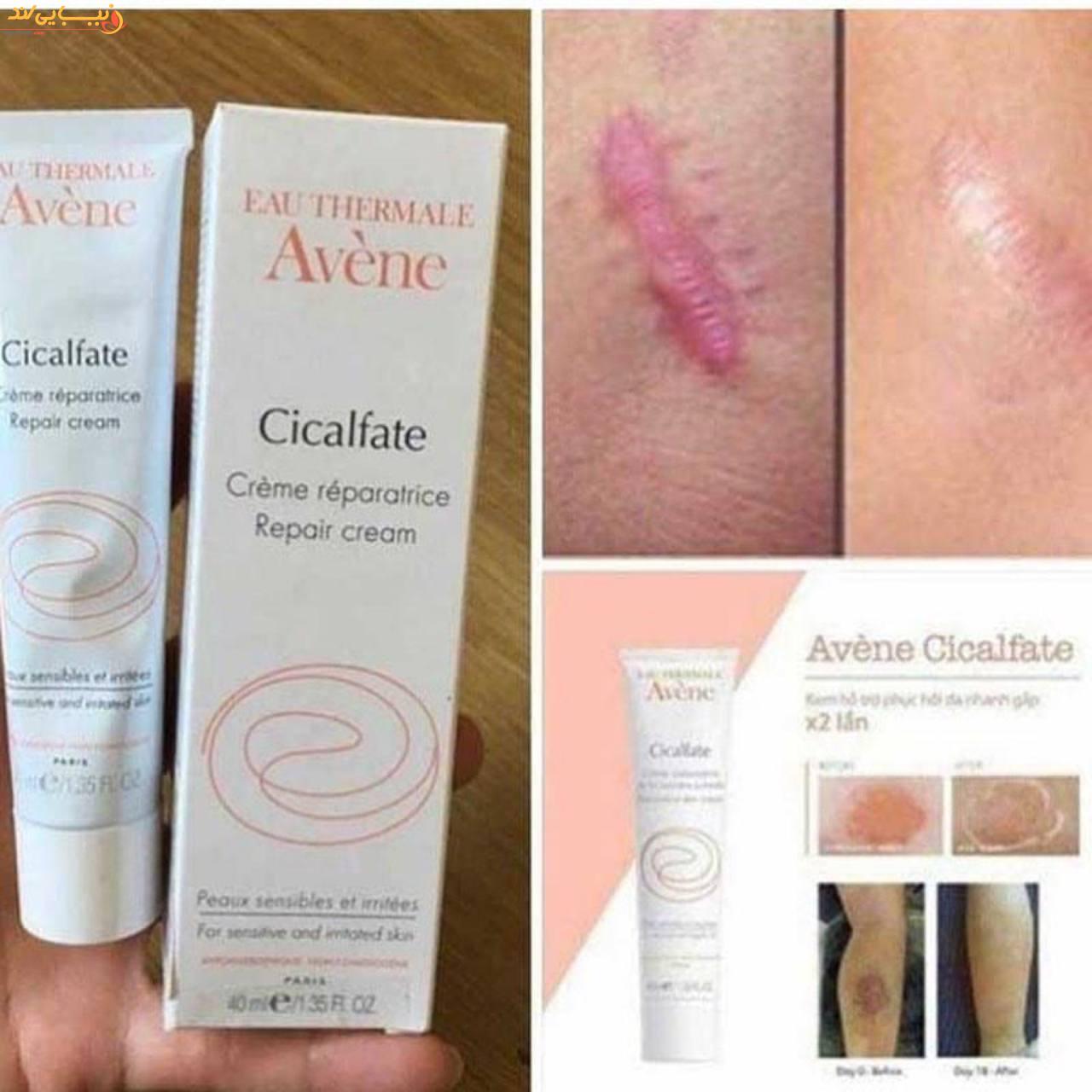 کرم ترمیم کننده پوست سیکالفیت پلاس اون Avene حجم 100میل — تصویر ۳