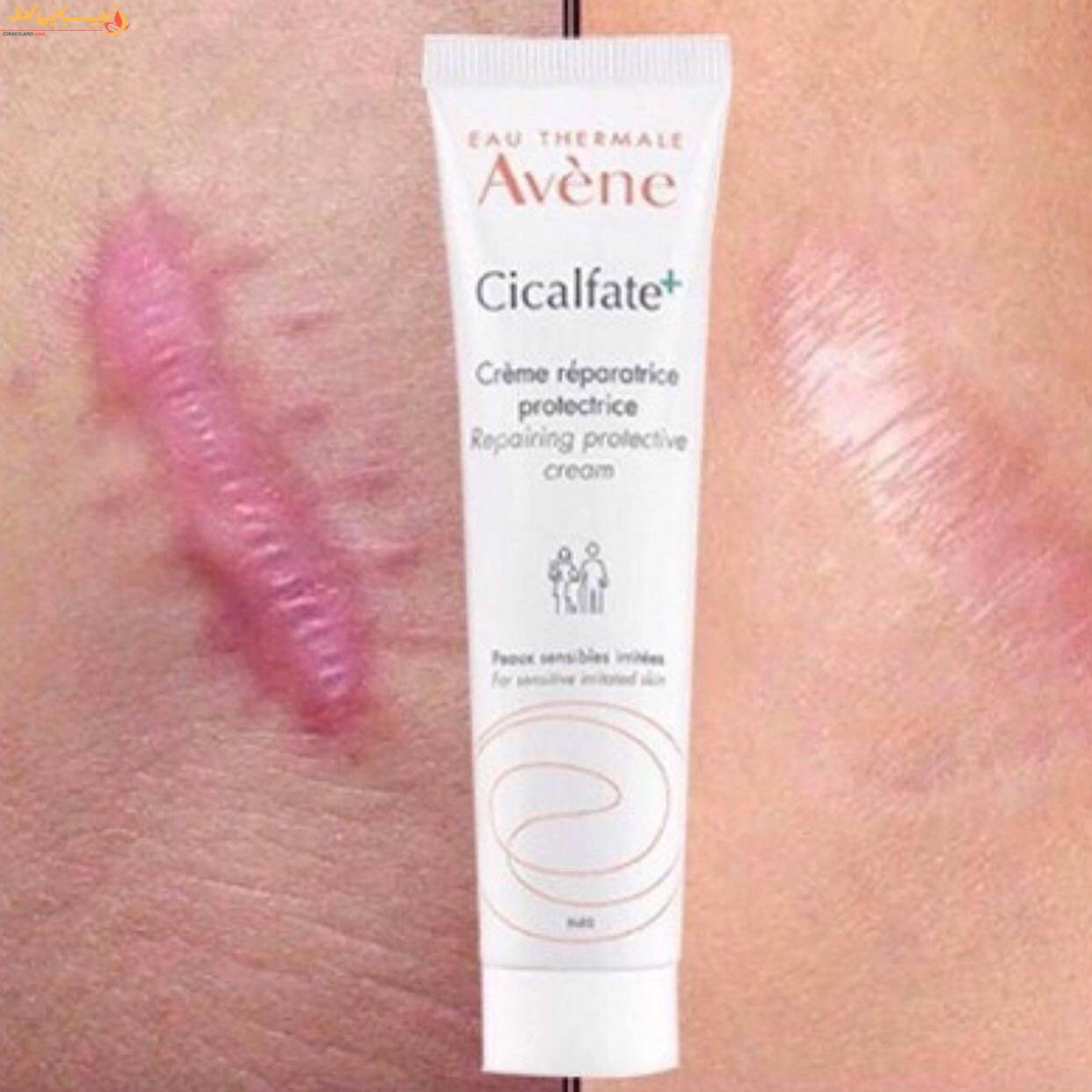 کرم ترمیم کننده پوست سیکالفیت پلاس اون Avene حجم 100میل — تصویر ۵