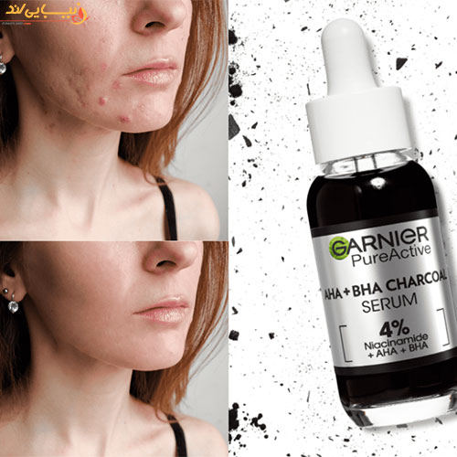 سرم لایه بردار زغال ضدلک و جوش گارنیر GARNIER – AHA+BHA حجم ۳۰ میل — تصویر ۳