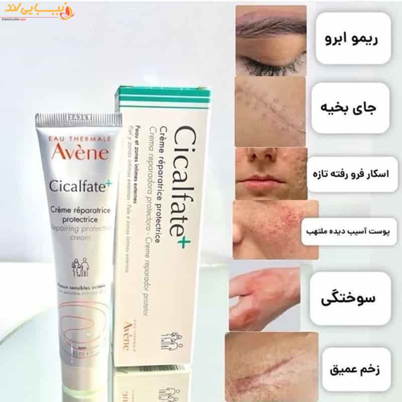 کرم ترمیم کننده سیکالفیت پلاس اون — تصویر ۵