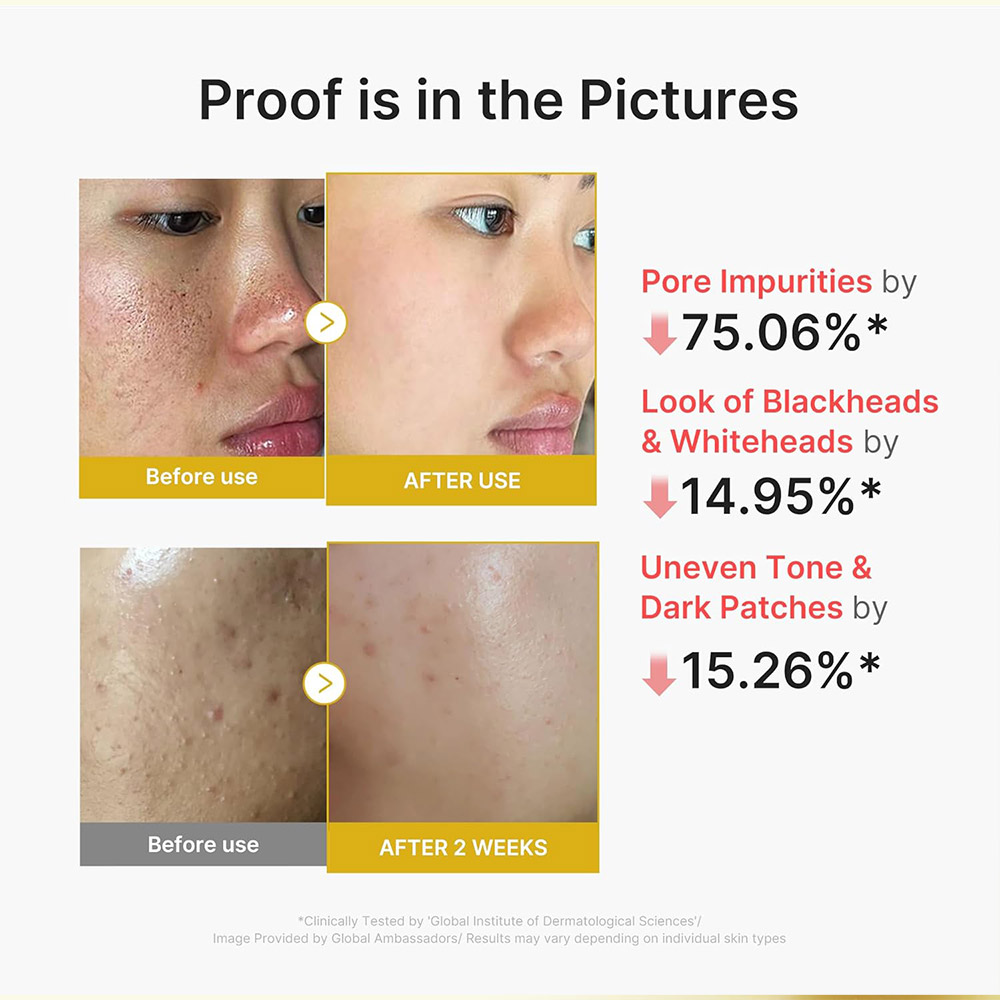 سرم پیل شات کوجیک اسید و زردچوبه مدی کیوب لایه بردار ملایم و روشن کننده قوی پوست medicube Kojic Acid Turmeric Peel Shot — تصویر ۵