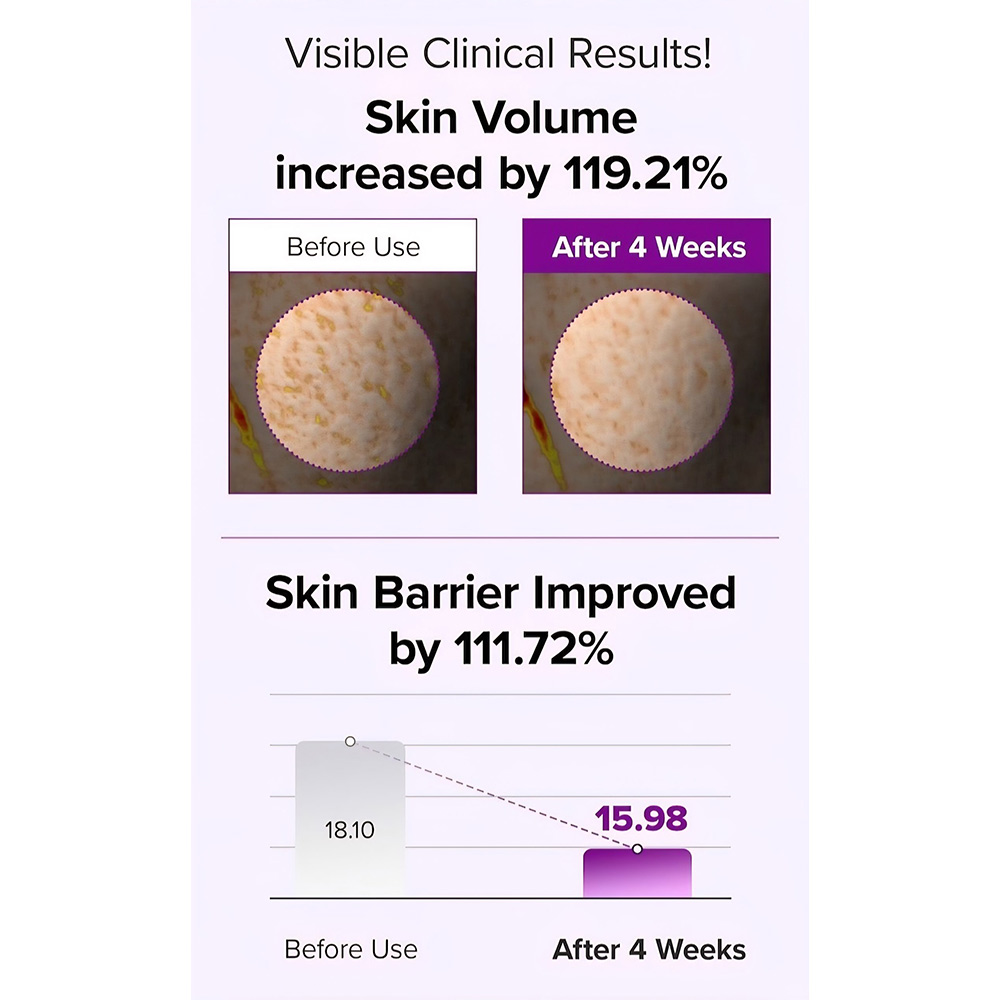 کرم اسپیکول کلاژن و PDRN مری اند می ضد چروک و ترمیم کننده پوست Mary & May Spicule Collagen PDRN Cream — تصویر ۸