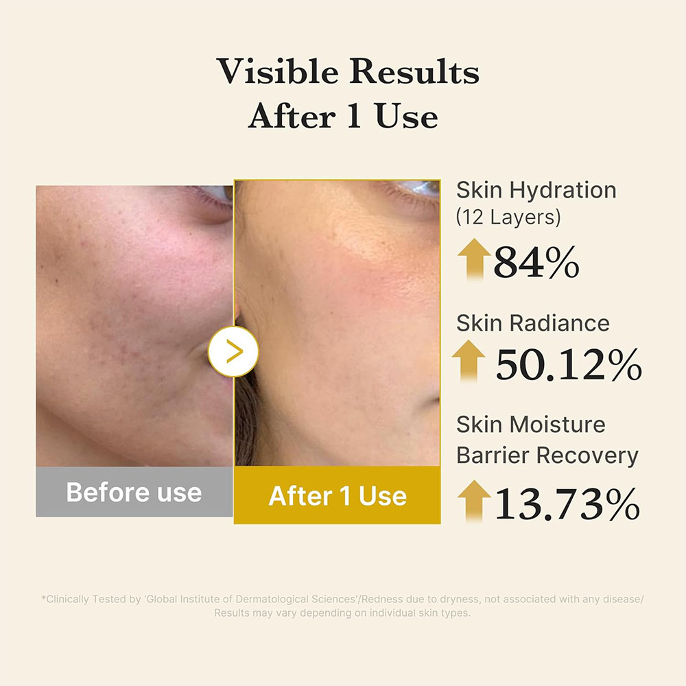 میست سرم ژلی کوجیک اسید و زردچوبه مدی کیوب روشن کننده و تسکین دهنده پوست Medicube Kojic Acid Turmeric Vita Jelly Mist Serum — تصویر ۷