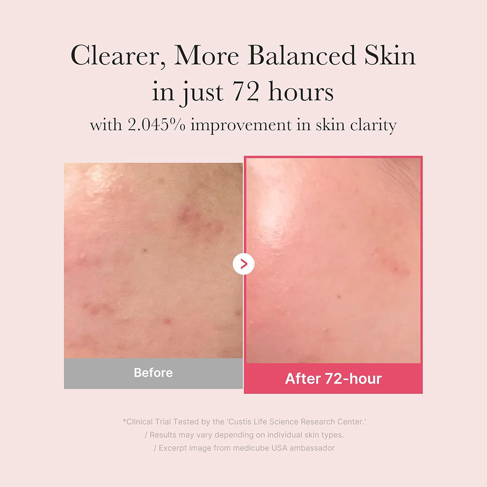 سرم ضد لک و روشن کننده ترانگزامیک اسید و نیاسینامید مدی کیوب MEDICUBE TXA Niacinamide 15% Serum — تصویر ۷