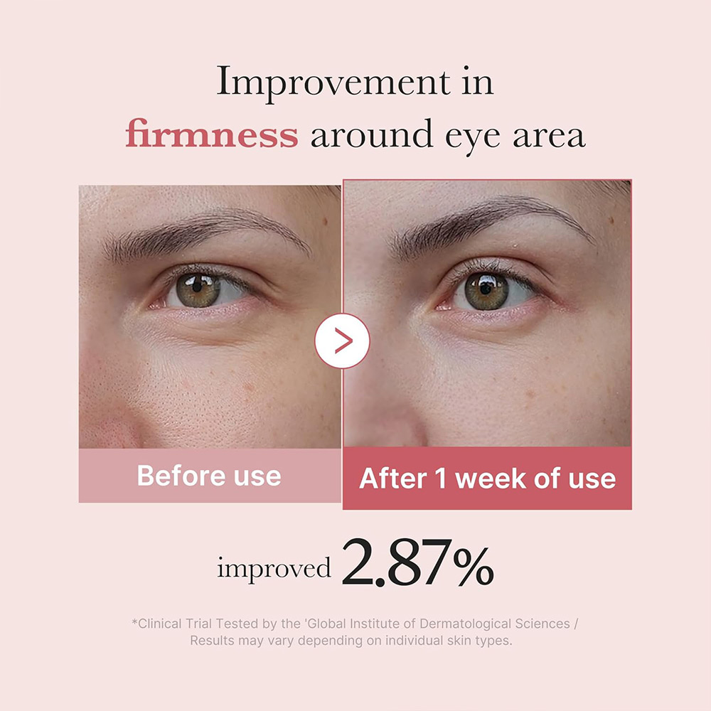 کرم دور چشم pdrn و پپتاید مدی کیوب ضد چروک و روشن کننده PDRN Pink Peptide Eye Cream — تصویر ۵
