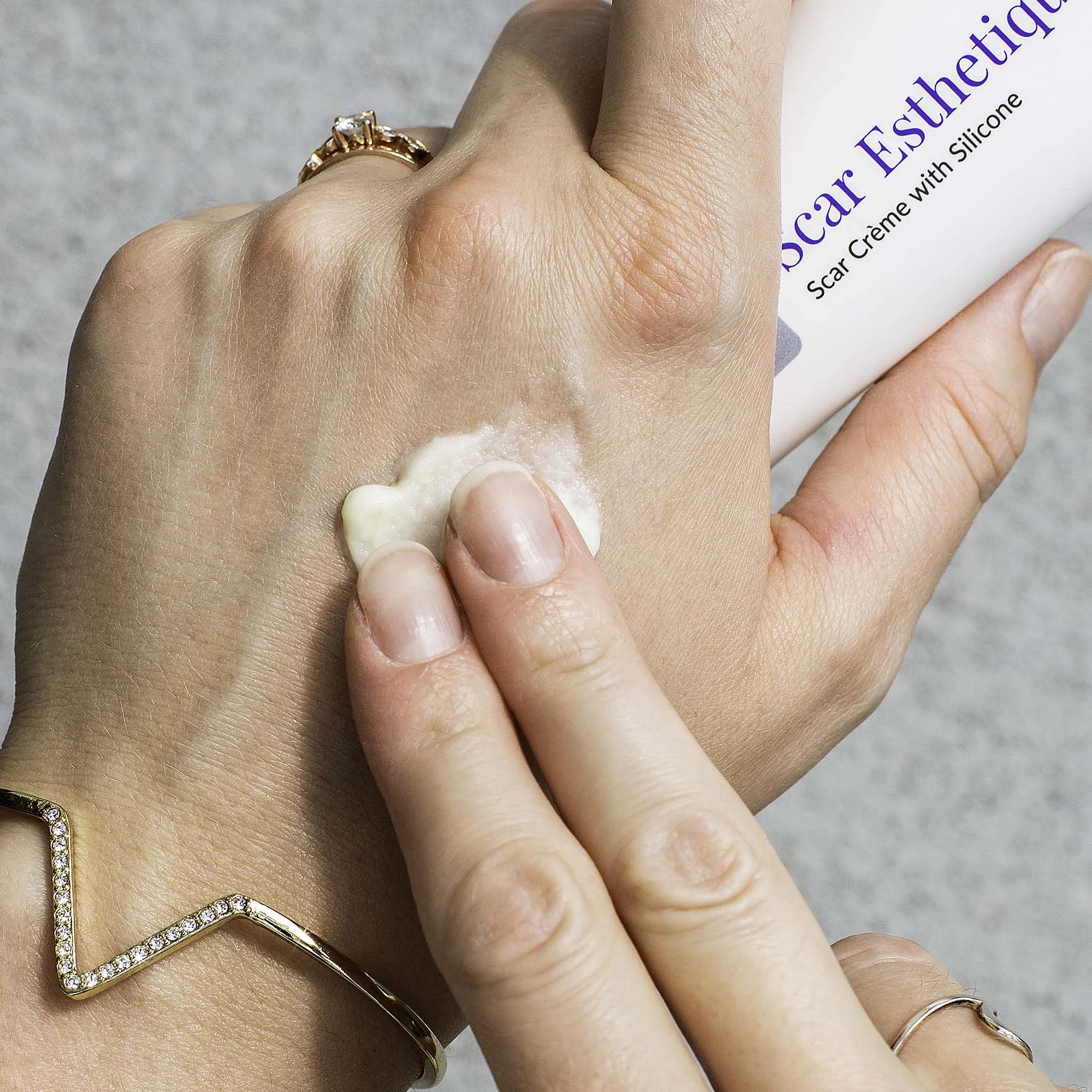 کرم سیلیکونی اسکار استاتیک Scar Esthetique — تصویر ۳