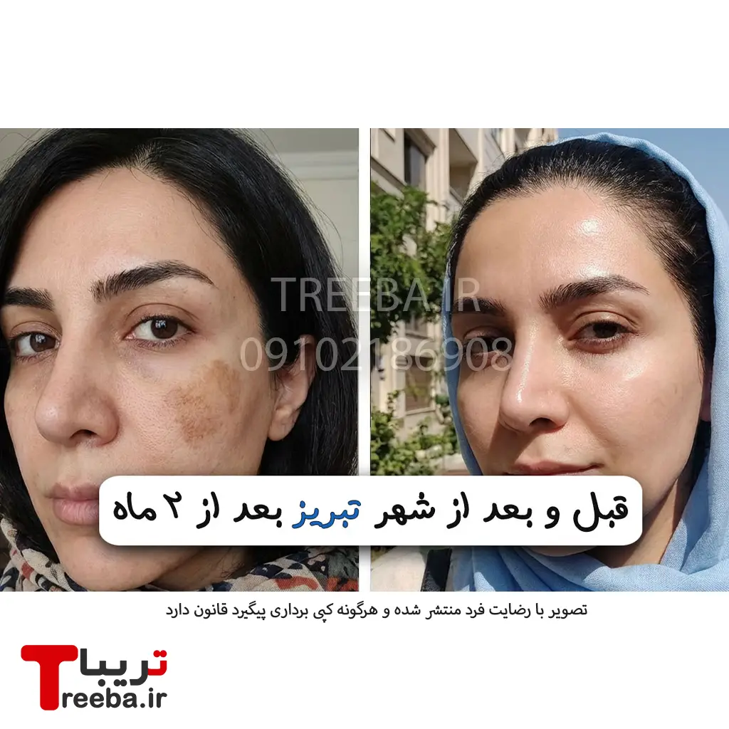 کرم ضد لک لاکچری کوین — تصویر ۶