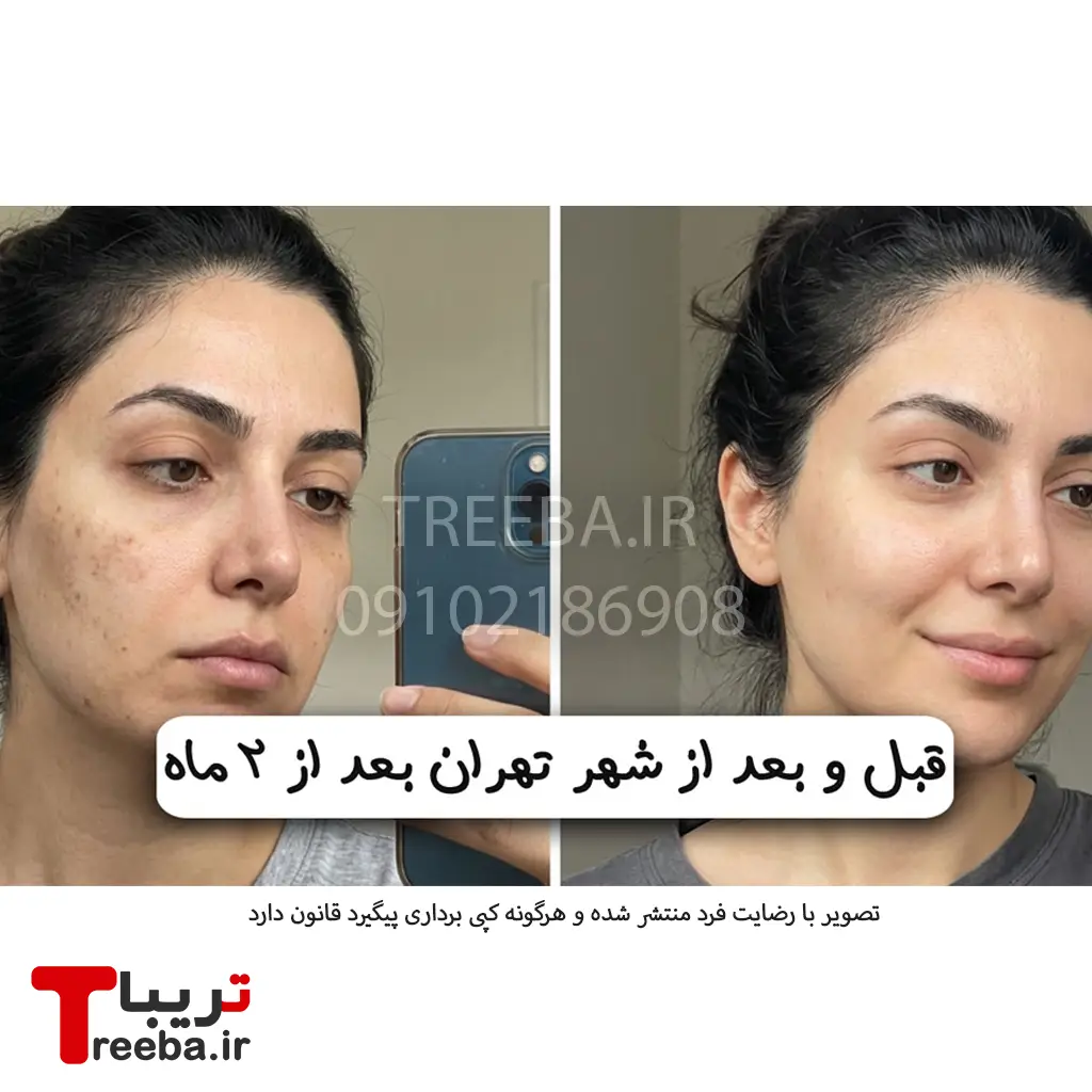 کرم ضد لک لاکچری کوین — تصویر ۷
