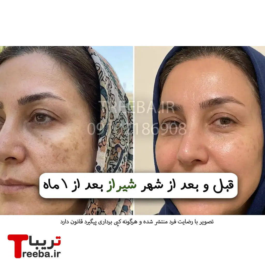 کرم ضد لک لاکچری کوین — تصویر ۸