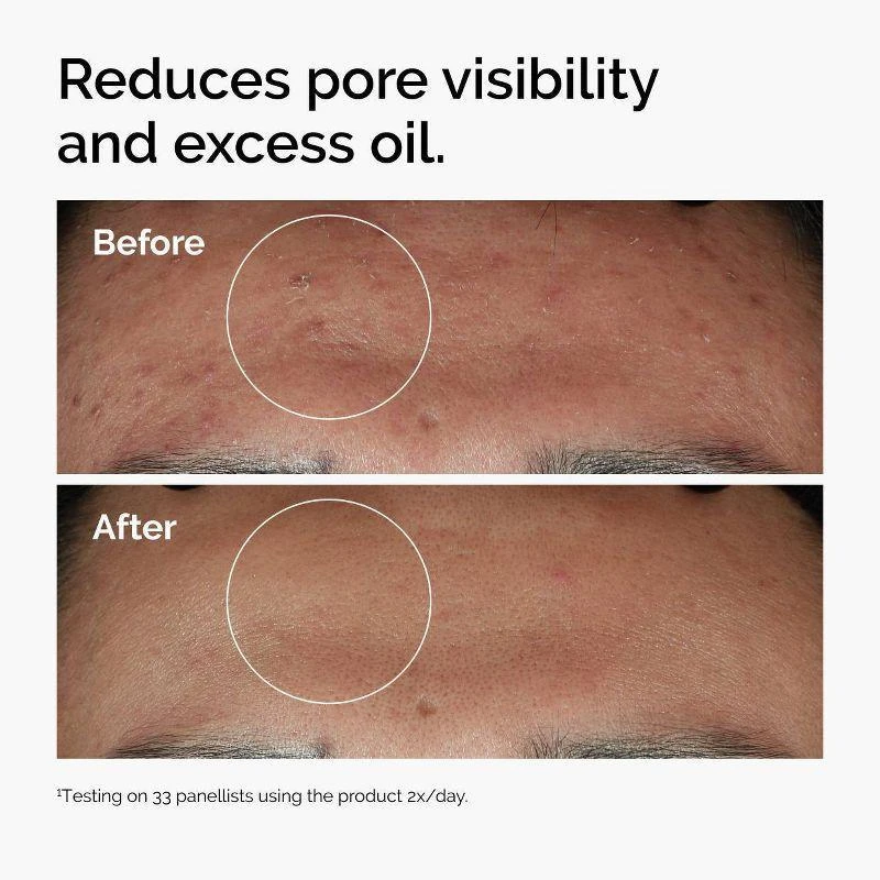 سرم ضدجوش اوردینری Ordinaryمدل نیاسینامید Niacinamide 10% اورجینال — تصویر ۳