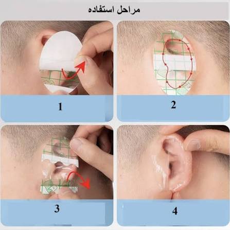 چسب محافظ گوش حمام نوزاد ضد آب — تصویر ۳