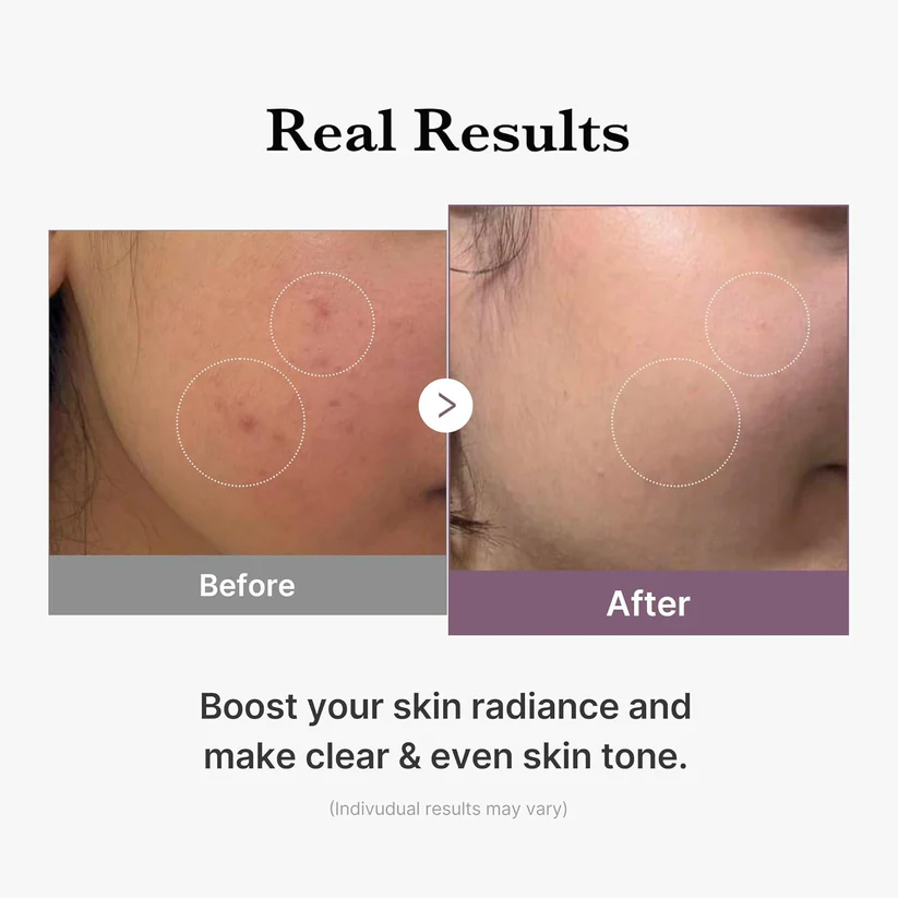 تونر گلوتاتیون مدی کیوب Medicube Age-R Glutathione Glow Toner — تصویر ۵