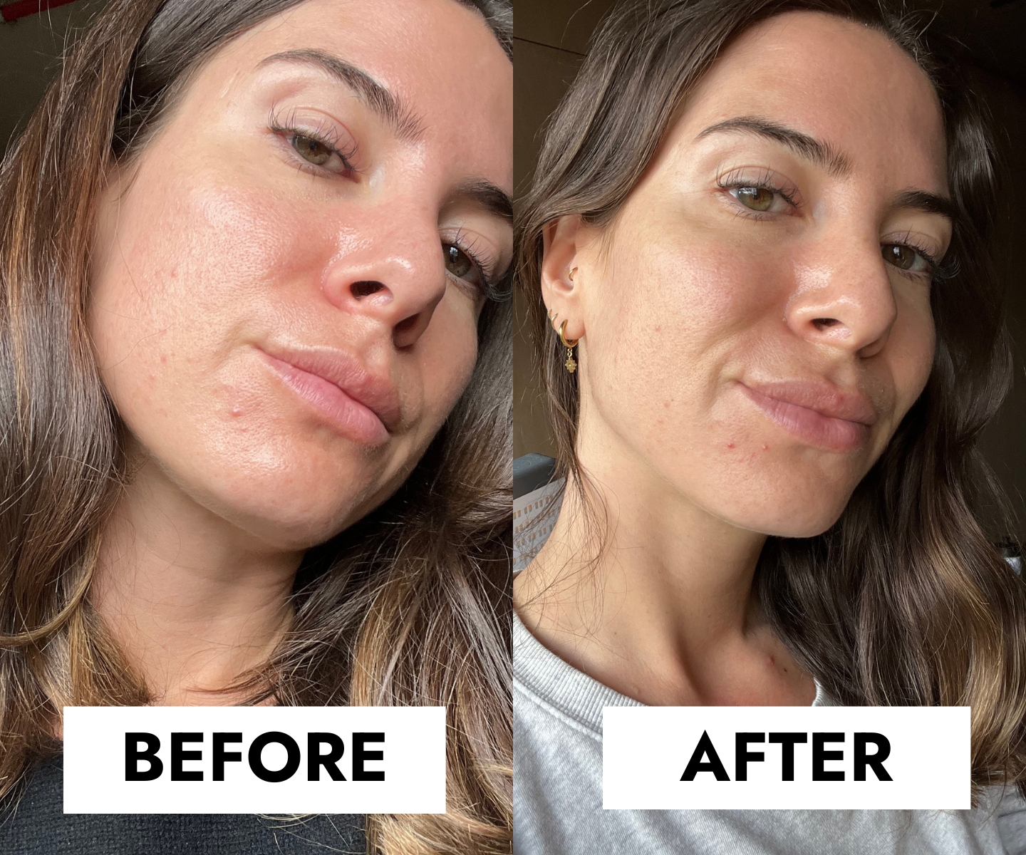 ژل شستشو ضد جوش و لک سراوی بلمیش کنترل Blemish Control مسترکپی — تصویر ۴