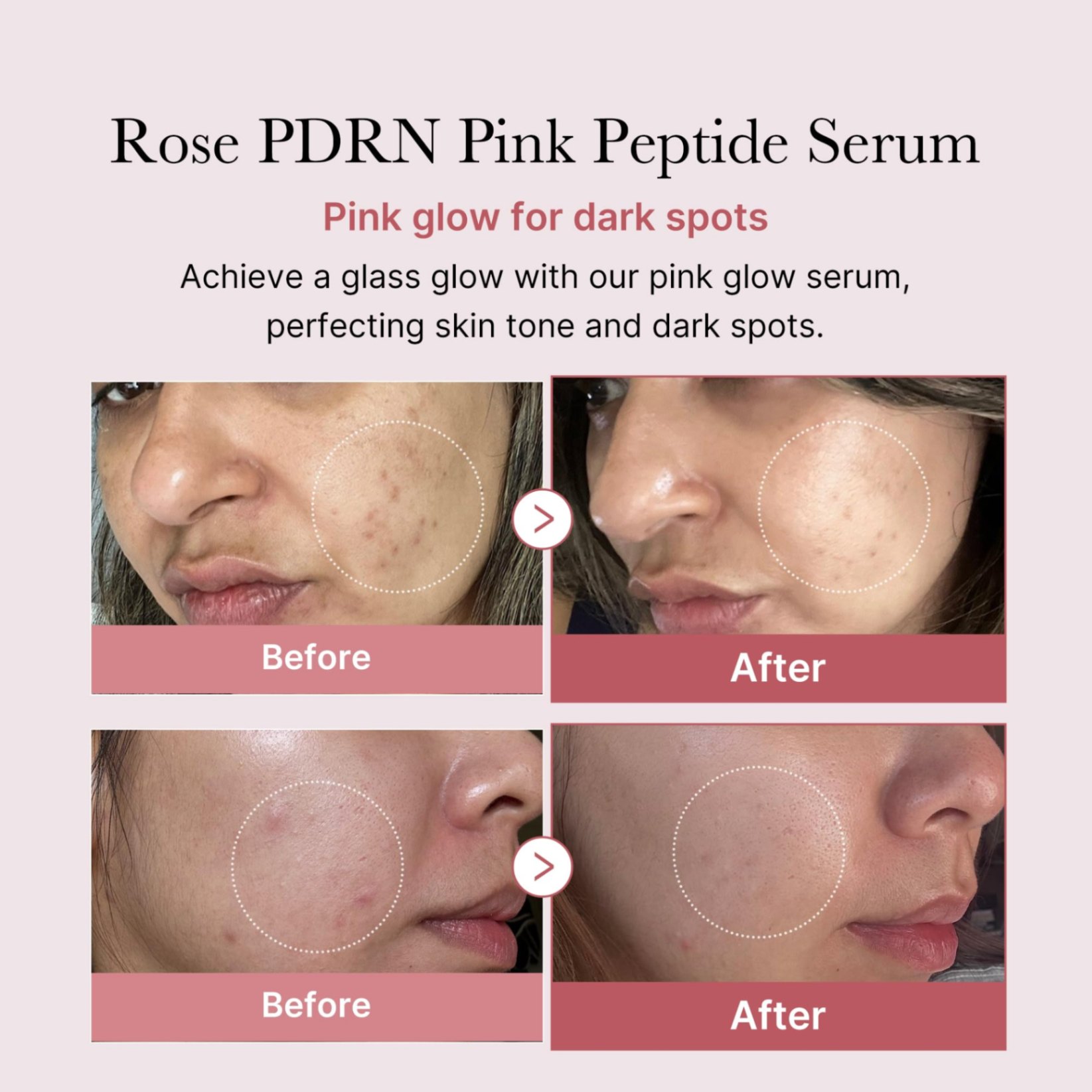 سرم صورتی روشن کننده پپتاید و PDRN مدی کیوب medicube PDRN pink peptide serum 30ml — تصویر ۶