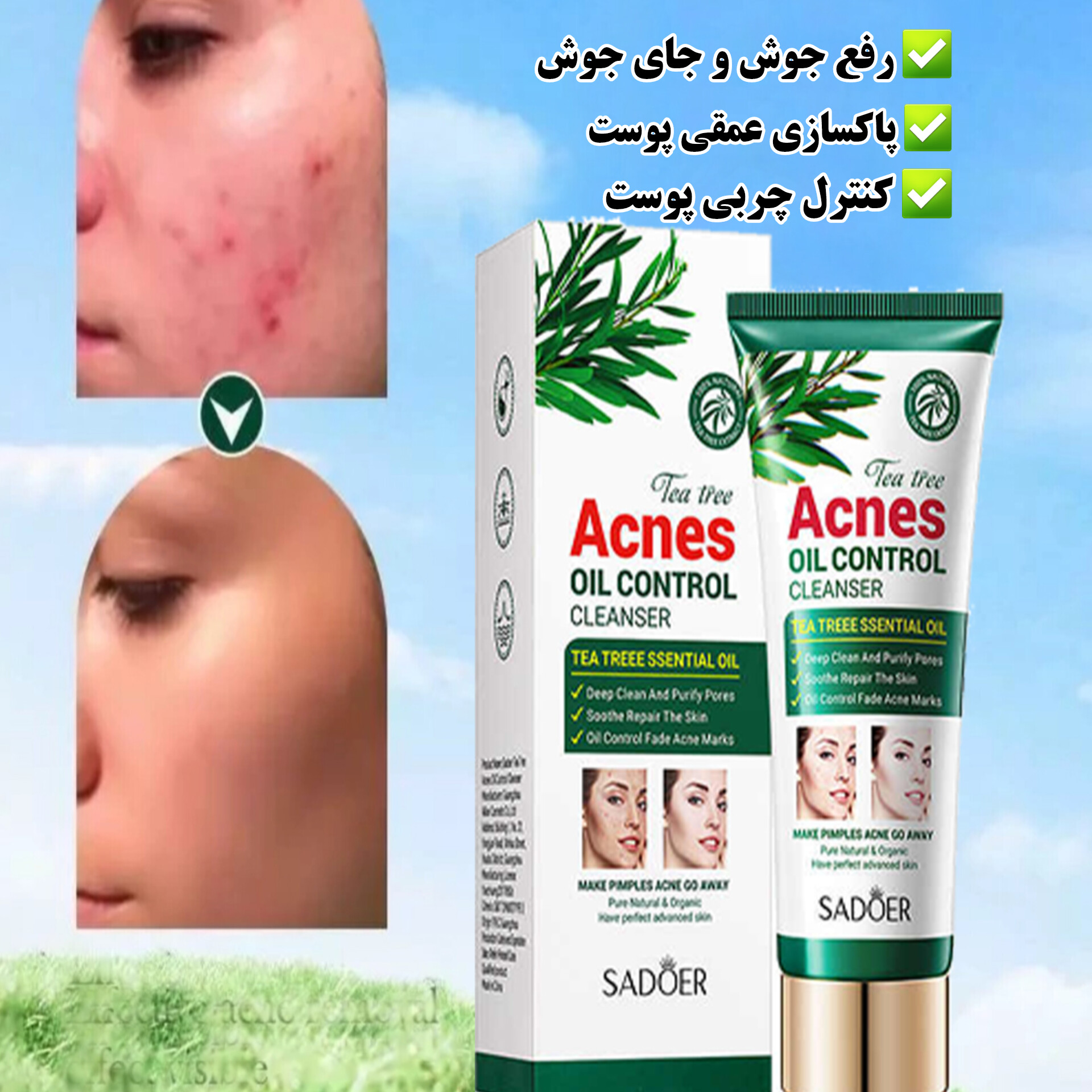 فوم شستشوی ضدجوش و آکنه چای سبز سادور — تصویر ۳