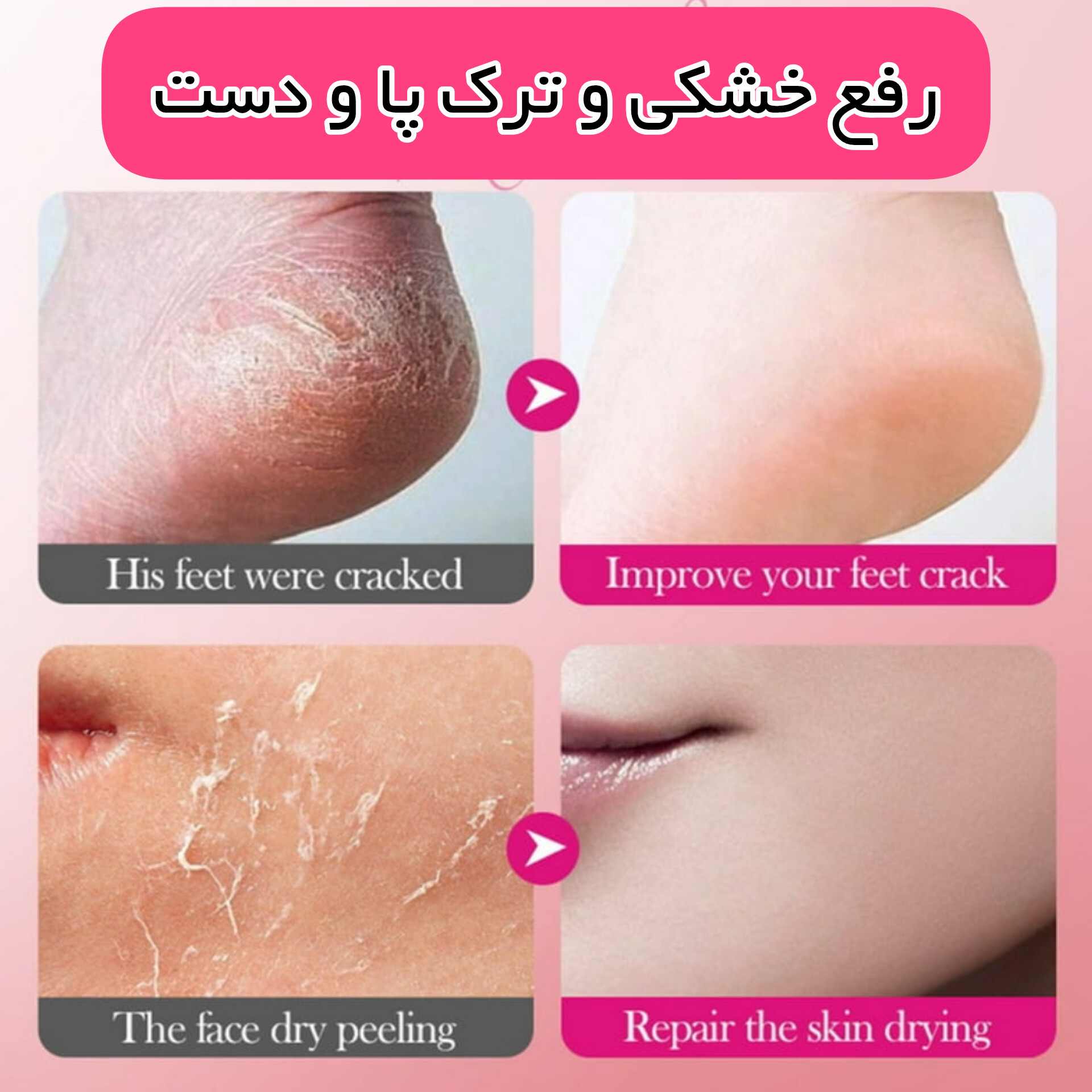 استیک رفع ترک و خشکی کف پا و دست — تصویر ۶