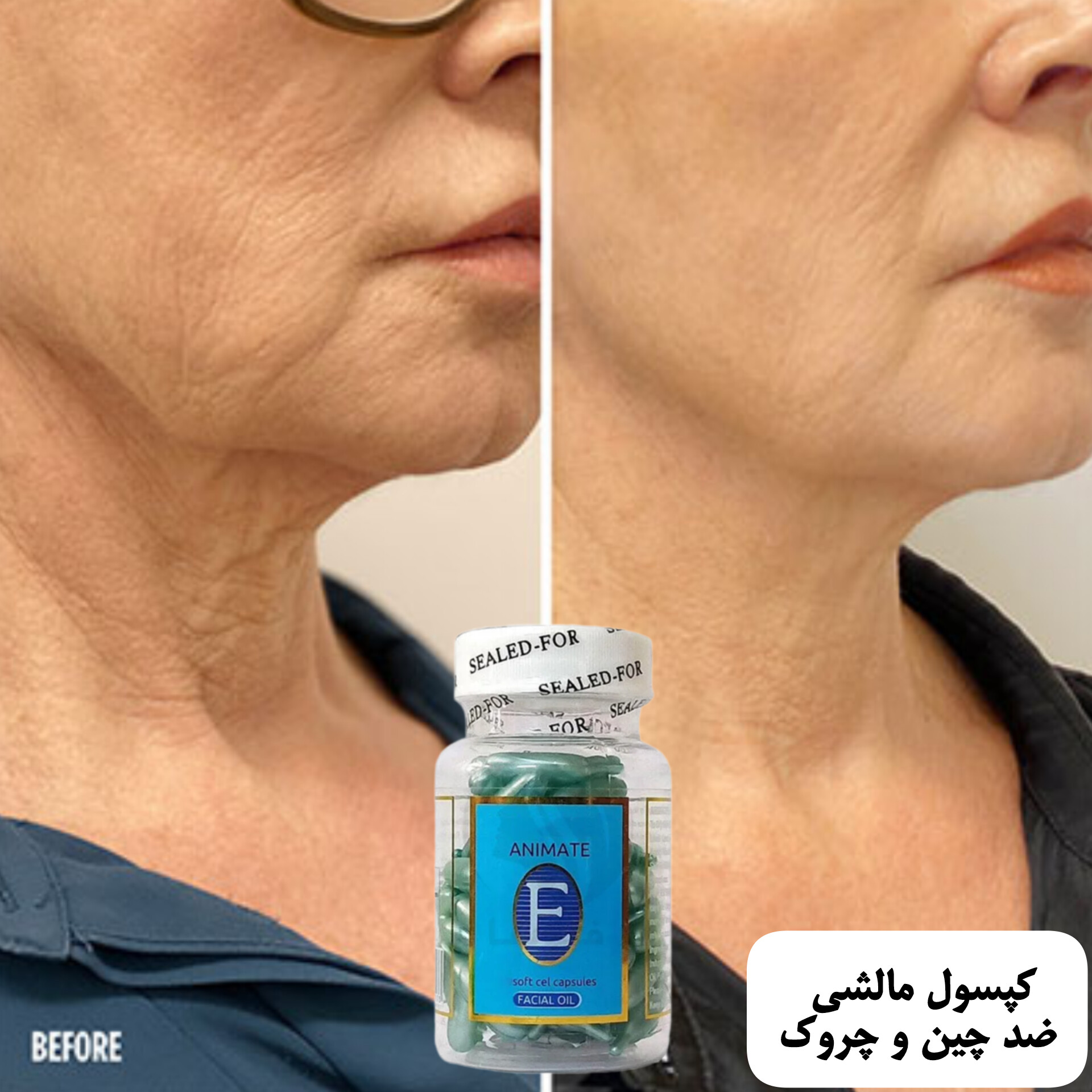 کپسول مالشی رفع چین و چروک — تصویر ۳