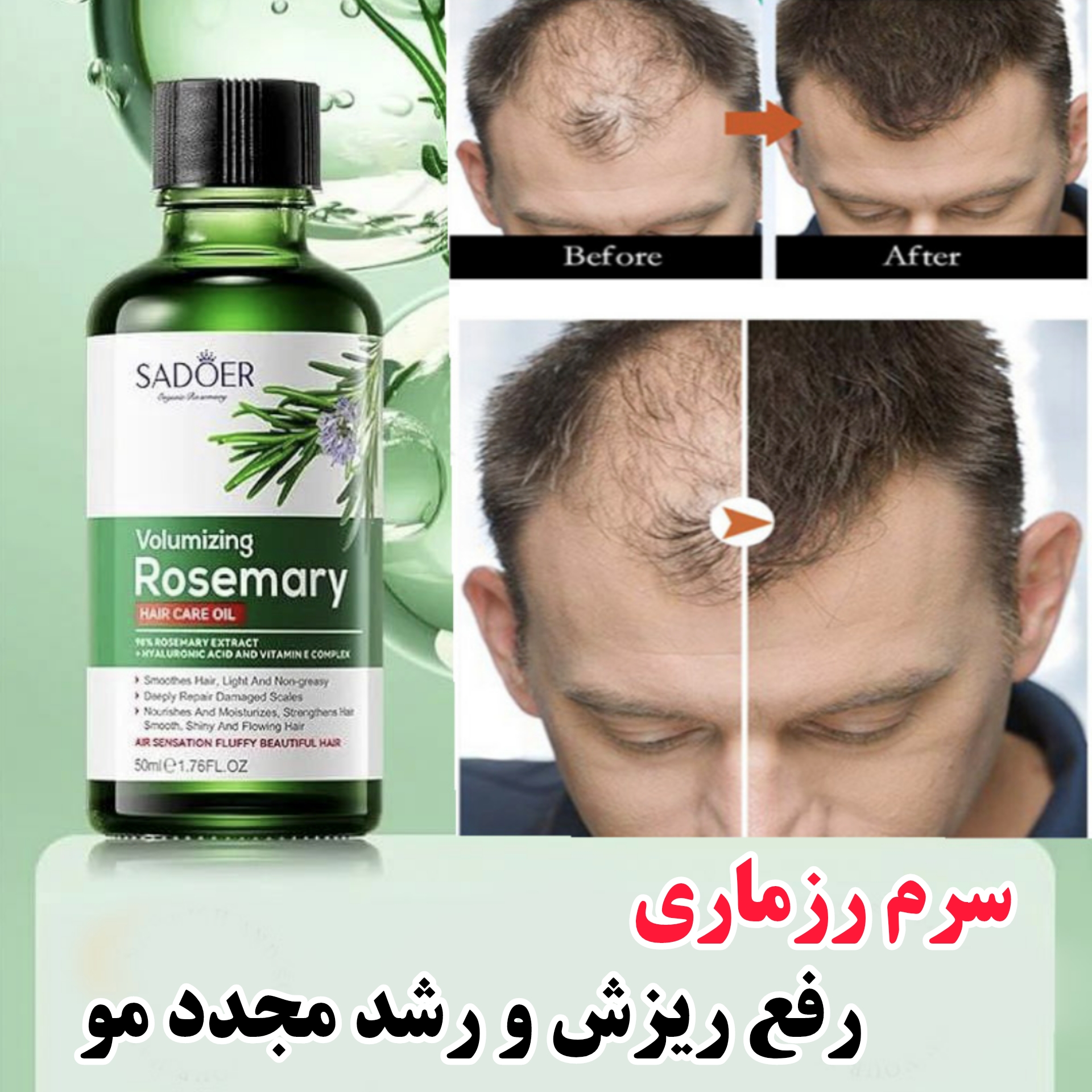 سرم روغن رزماری