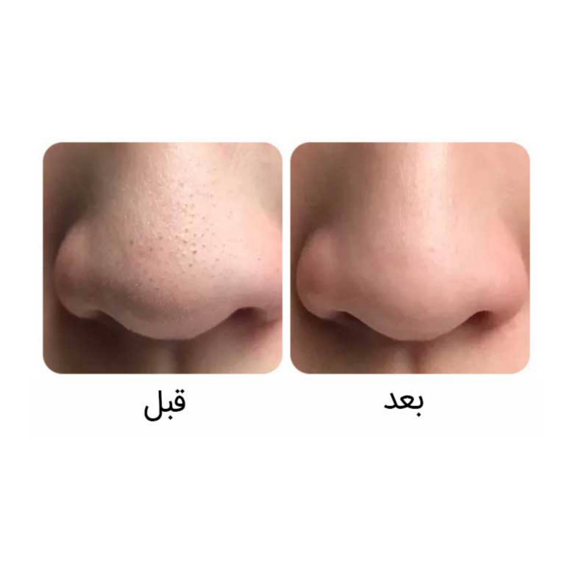 ماسک سه مرحله ای بینی بیوآکوا — تصویر ۵