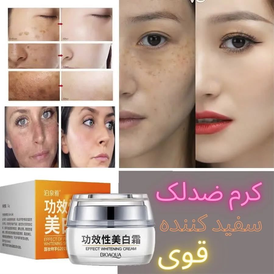 کرم ضد لک و ضد آکنه بیوآکوا — تصویر ۲