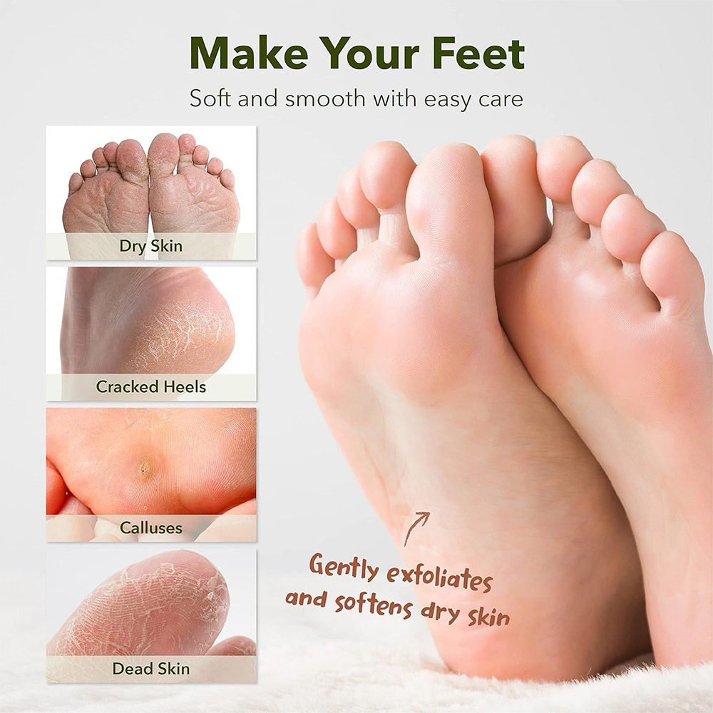 ماسک لایه بردار و نرم کننده پا پیوردرم Purederm Shiny & Soft Foot Peeling Mask — تصویر ۴