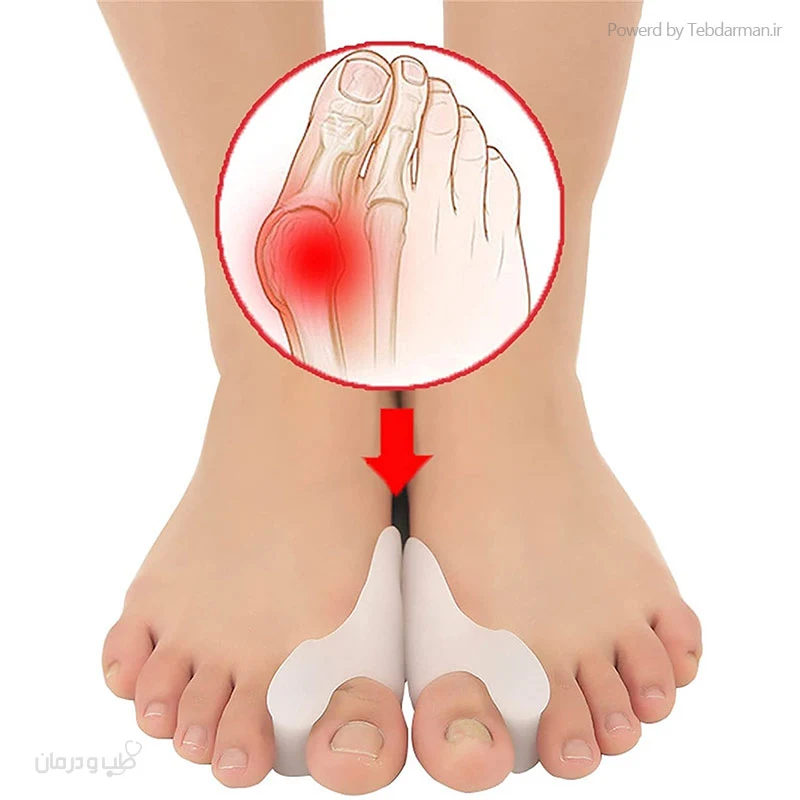 فاصله دهنده سیلیکونی ساپورت دار انگشت شست — تصویر ۳