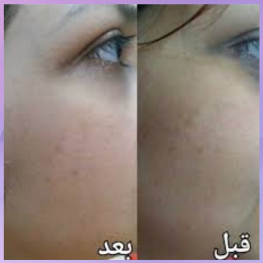 قیمت کرم معجزه شب بدن در داروخانه — تصویر ۴