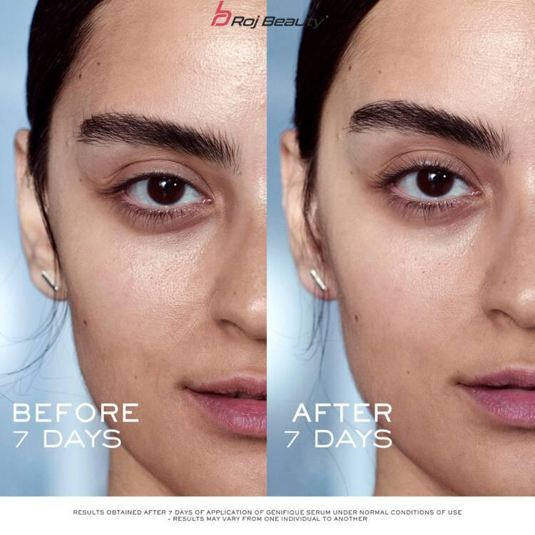 سرم جوان کننده پوست جنفیک لانکوم حجم ۱۰۰ میلLancôme Advanced — تصویر ۴
