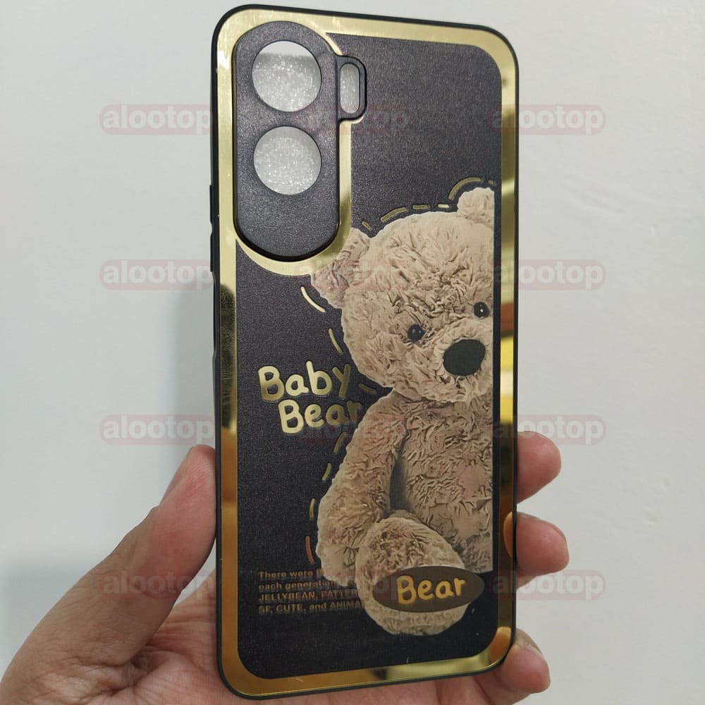 قاب فانتزی دور طلایی آنر 90 لایت (Honor 90 Lite) – لاکچری محافظ لنز دار — تصویر ۴