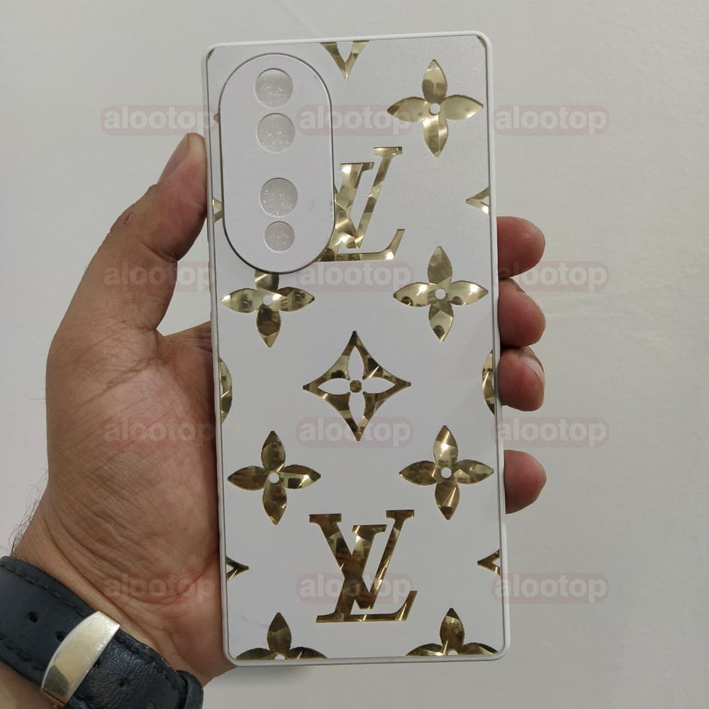 قاب آنر 70 (Honor 70) محافظ لنز دار لاکچری — تصویر ۷