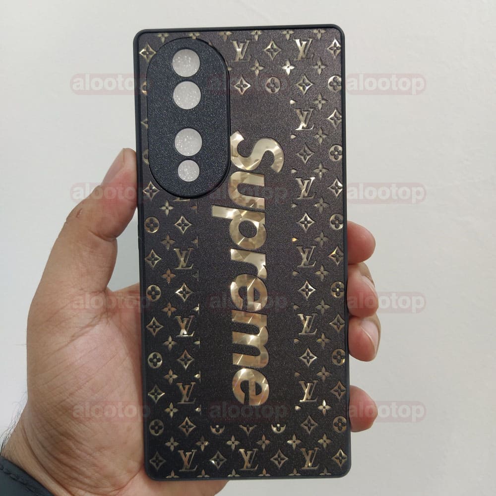 قاب آنر 70 (Honor 70) محافظ لنز دار لاکچری — تصویر ۸