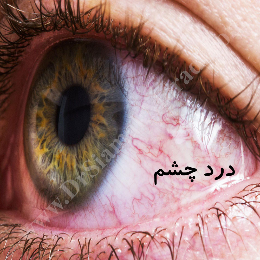 دانلود جزوه پرستاري داخلي و جراحي چشم استاد توكلي — تصویر ۳