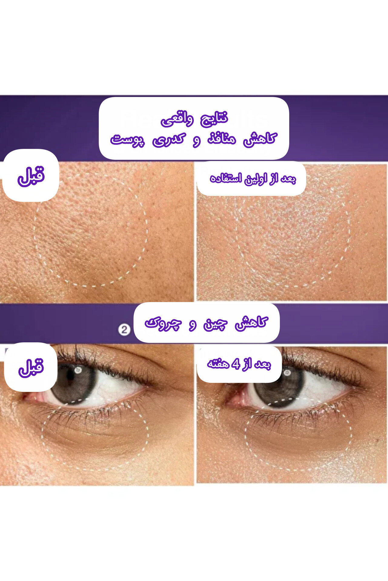 سرم لیفتینگ نامبوزین شماره 9 NAD+ BIO Complex — تصویر ۳