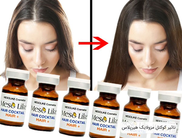 کوکتل تقویت مو سر هیر پلاس مزولایک Hair+ — تصویر ۴