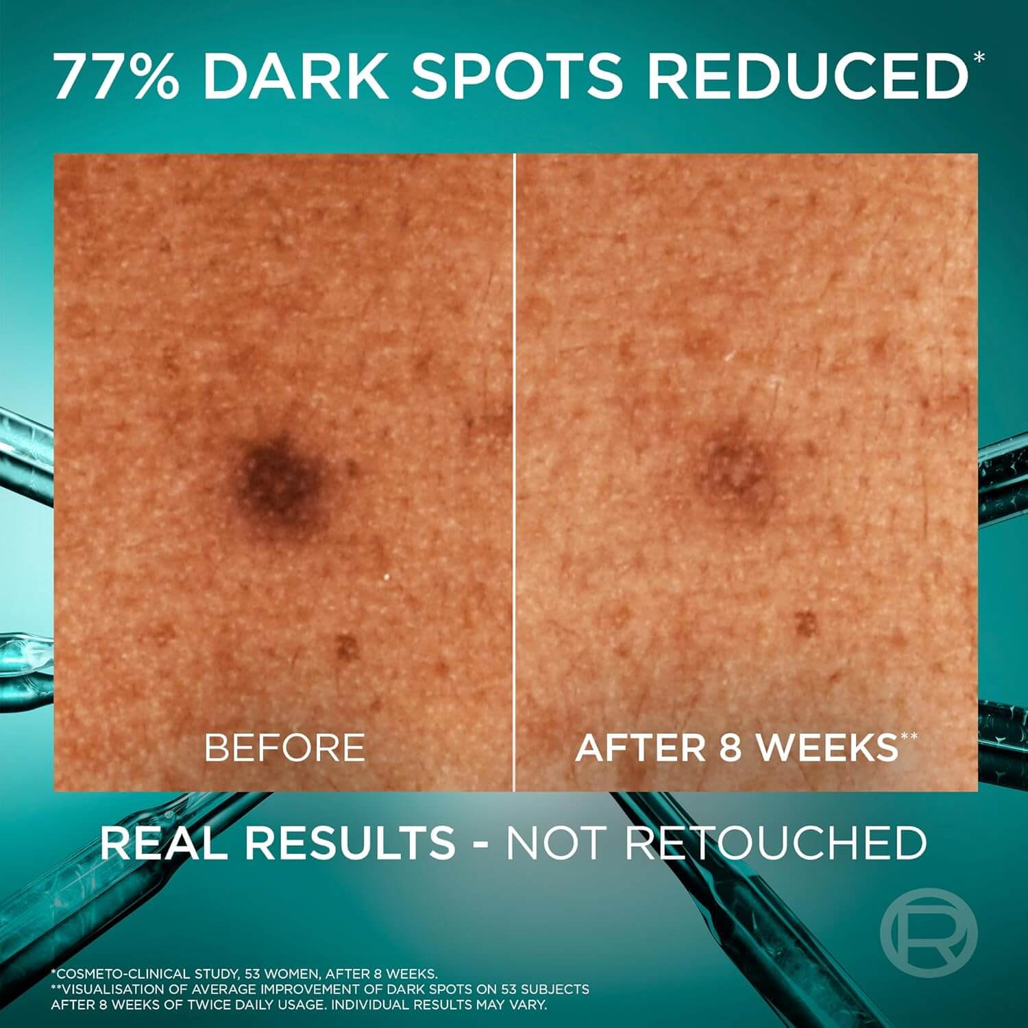 سرم ضدلک و روشن‌کننده نیاسینامید برایت ریویل لورآل 30 میل L’Oreal Paris Bright Reveal Niacinamide Dark Spot Serum — تصویر ۴