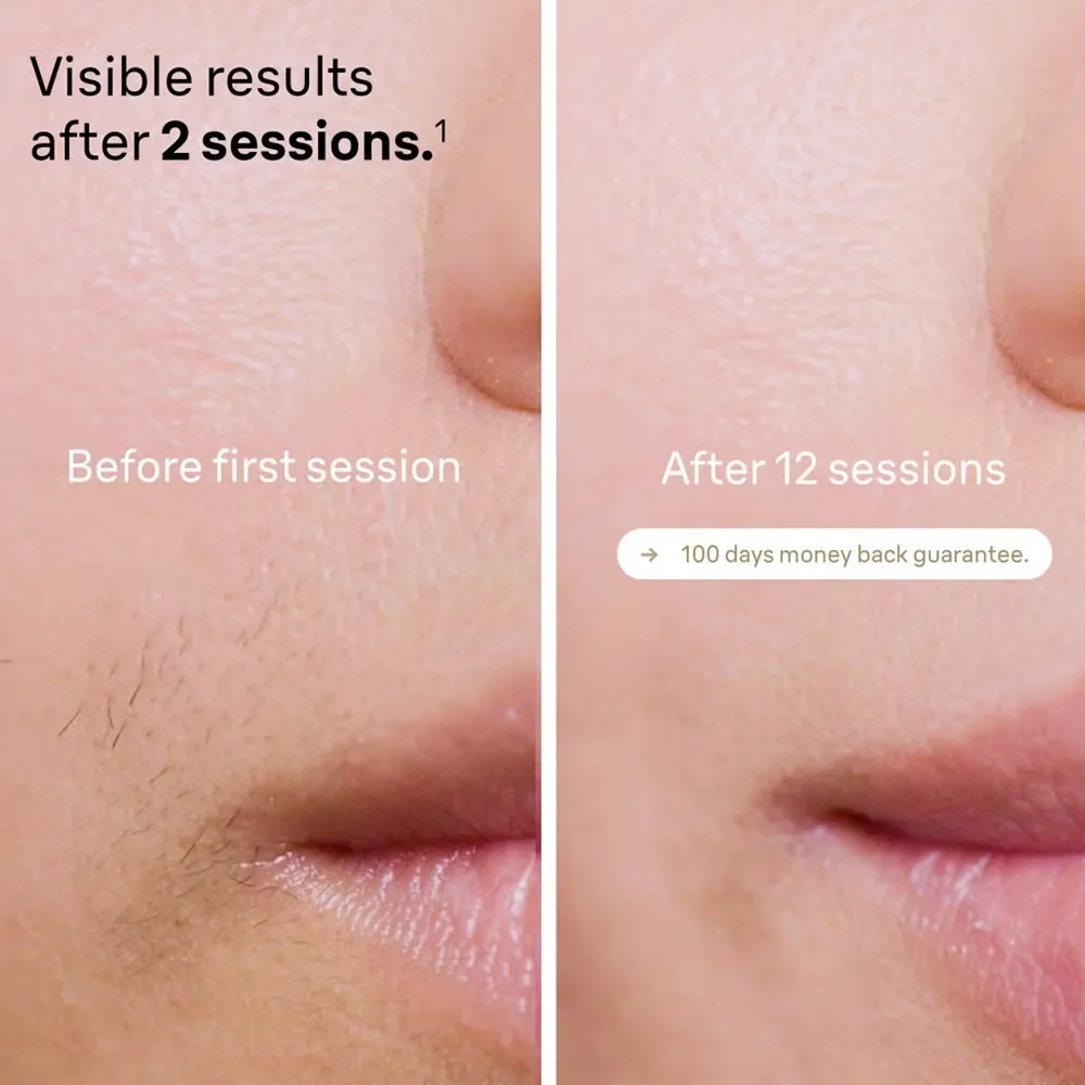 لیزر بدن براون مدل Silk-expert Pro 5 PL5146 — تصویر ۶