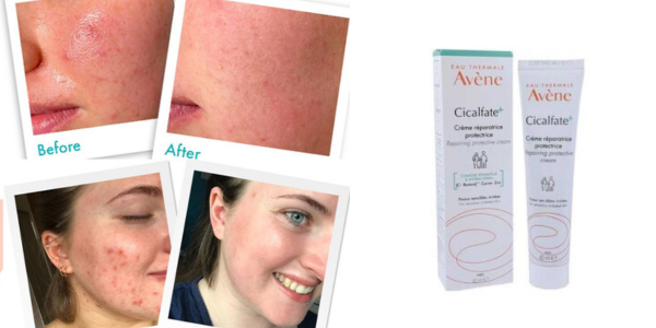 کرم ترمیم کننده پوست سیکالفیت پلاس اون Avene حجم 40 میل — تصویر ۵