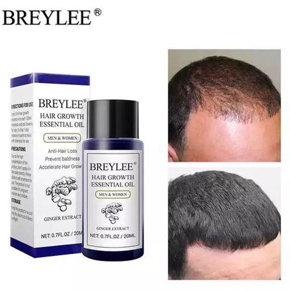 سرم و روغن رشد و تقویت مو بریلی Breylee — تصویر ۴