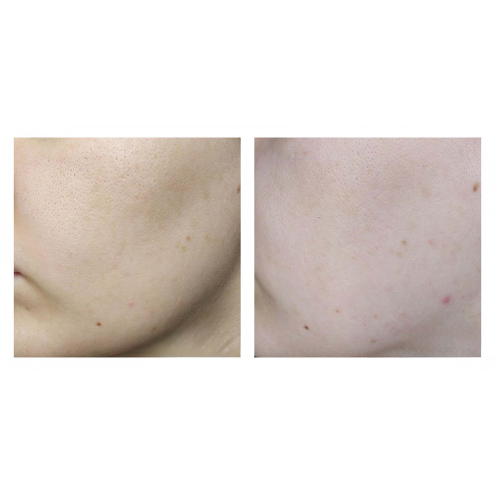 ژل شسستشو سراوی (100%اصل+به قیمت پخش) SA پوست زبر و خیلی خشک — تصویر ۷