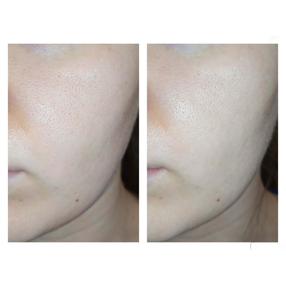 ژل شسستشو سراوی (100%اصل+به قیمت پخش) SA پوست زبر و خیلی خشک — تصویر ۵