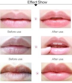 بالم لب وازلین حاوی عصاره آلوئه ورا Vaseline Aloe Vera Lip Therapy — تصویر ۵