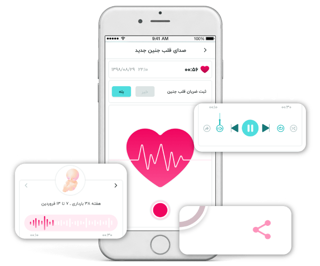 سونیکید جامپر – شنود صدای قلب جنین جامپر مدل AngelSounds JPD-100S9 — تصویر ۷