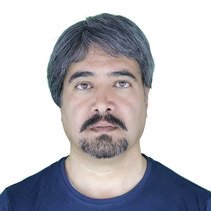 کلاه گیس مردانه جو گندمی با 70 درصد موی سفید و ظاهر طبیعی — تصویر ۶